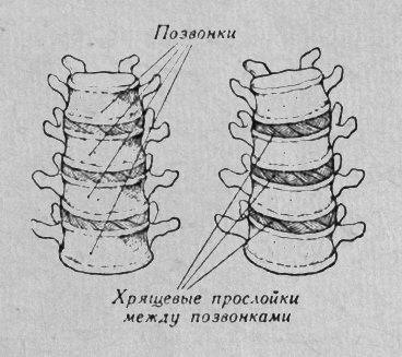 Непрерывное соединение костей (при помощи хряща)